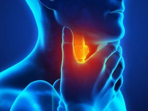 5 dấu hiệu ung thư tuyến giáp giai đoạn 1: Phát hiện sớm có thể kéo dài sự sống
