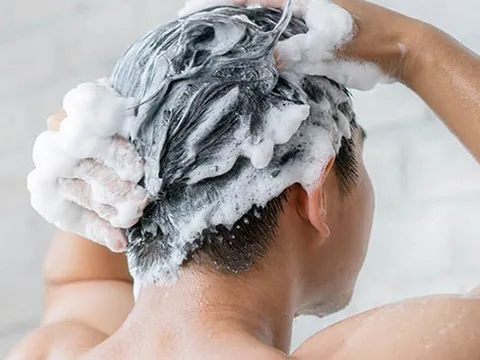 5 bước gội đầu đúng cách ngăn ngừa gàu, giảm tóc gãy rụng