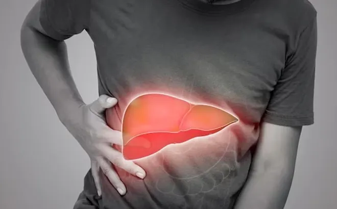 4 dấu hiệu trên cơ thể cảnh báo bệnh gan đã đi vào giai đoạn nặng